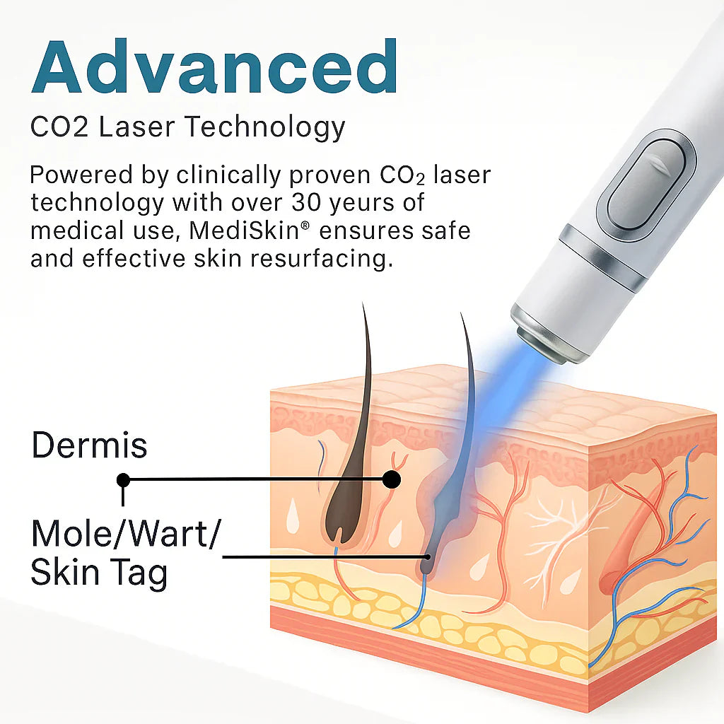 Mediskin Laser Pen
