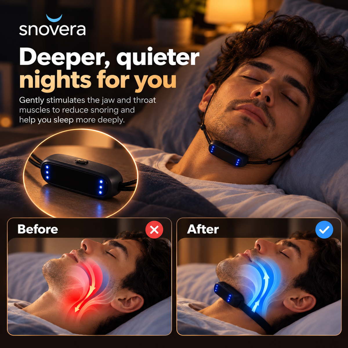 EMS Anti-Snoring Device